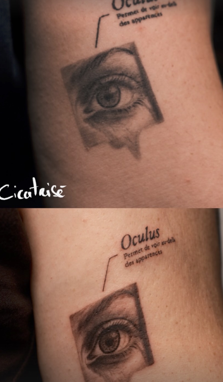 Tatouage œil en micro-réalisme, avant et après cicatrisation, Couleur Gris Bordeaux
