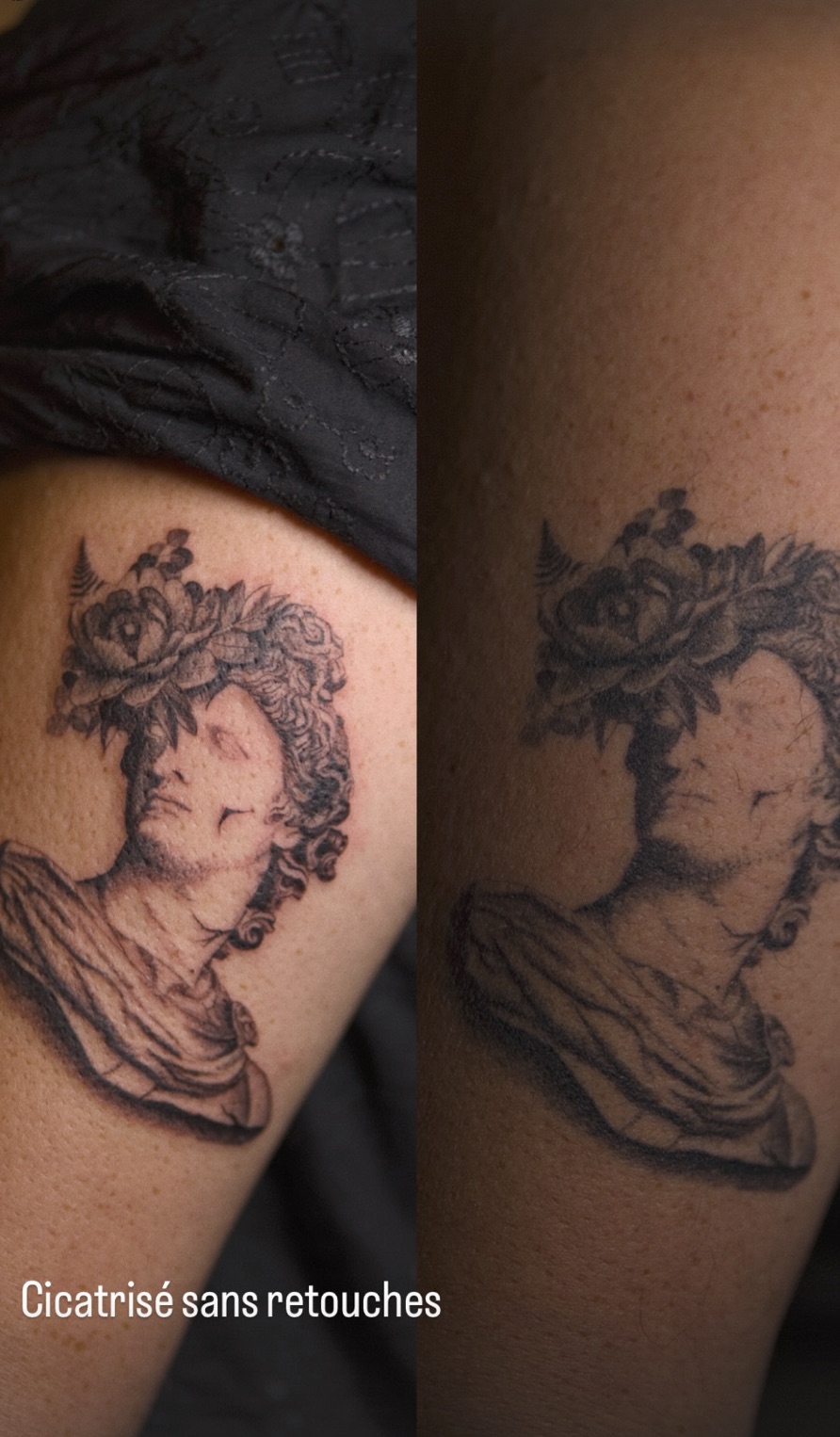 Tatouage statue en micro-réalisme, avant et après cicatrisation, Couleur Gris Bordeaux